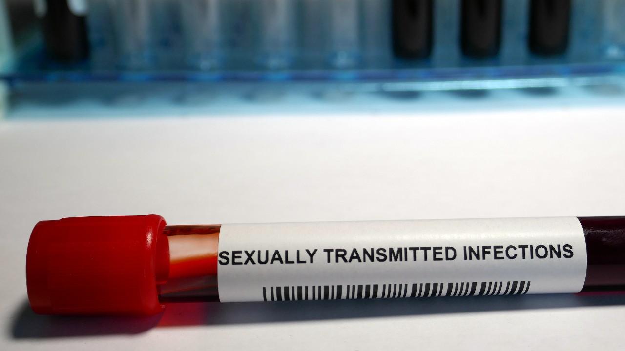 STI test 1280.jpg